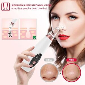 Multi Functional Cleaning Remove Blackhead Device